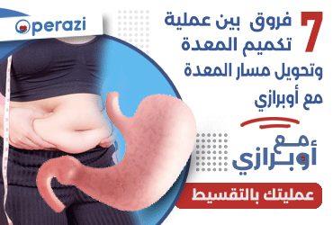 7 فروق بين عملية تكميم المعده وتحويل مسار المعدة مع اوبرازي